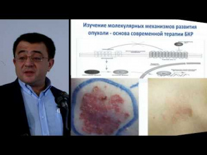 ВИДЕО : А.Ю. Бохян, РОНЦ -townstream - «Базальноклеточный рак кожи»