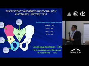 ВИДЕО : Современное состояние диагностики и лечения сарком мягких тканей в РФ